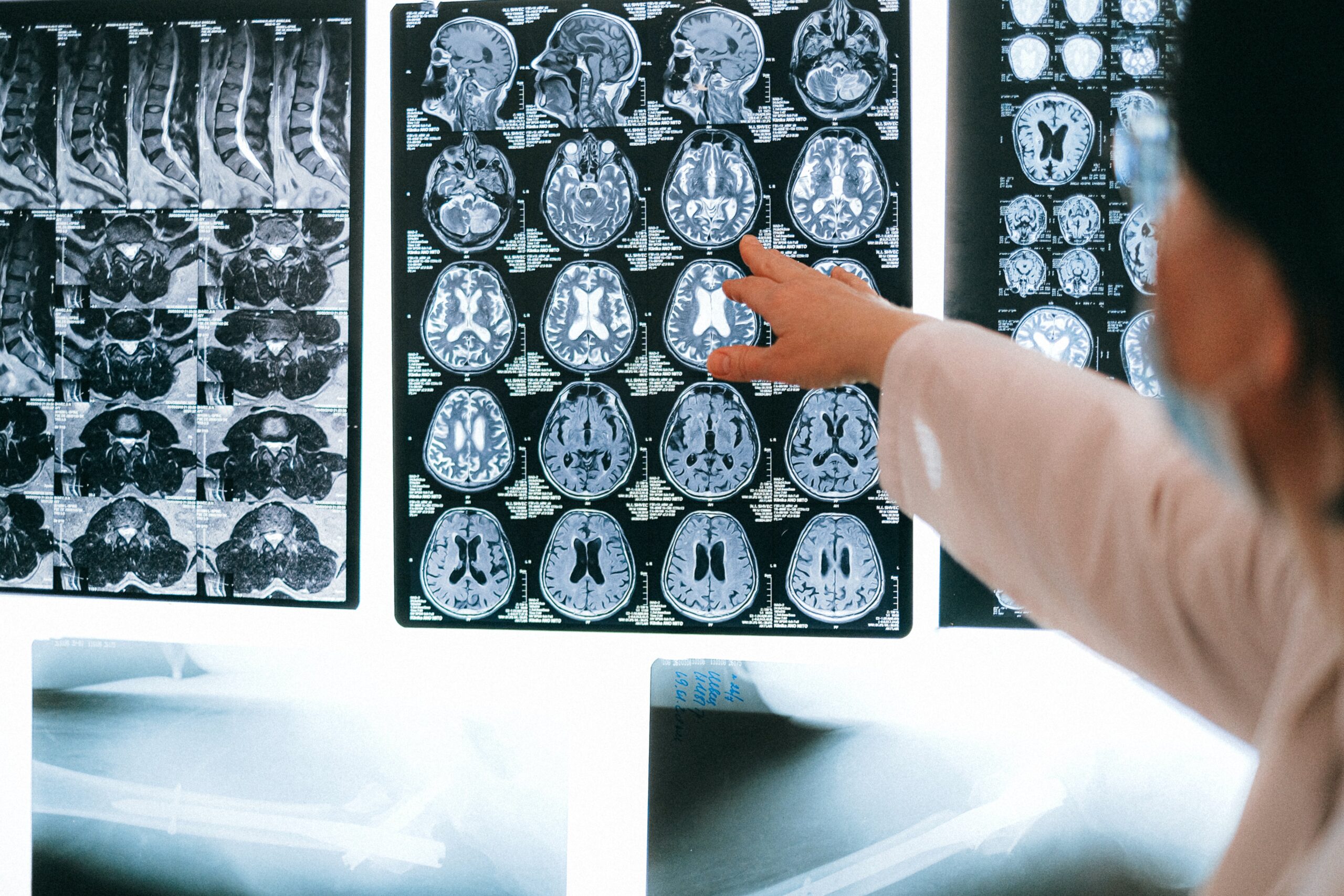 Top Interesting Reasons For The Scientist To Move Away From The Brain Scan