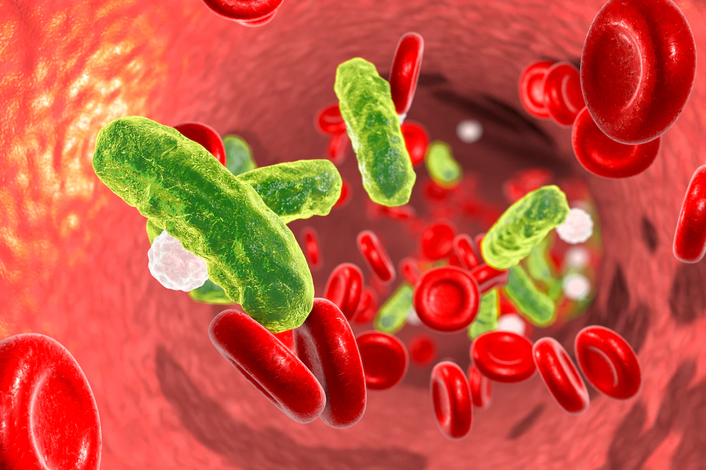 FDA Approves Prenosis Software as First AI Tool for Sepsis Diagnosis