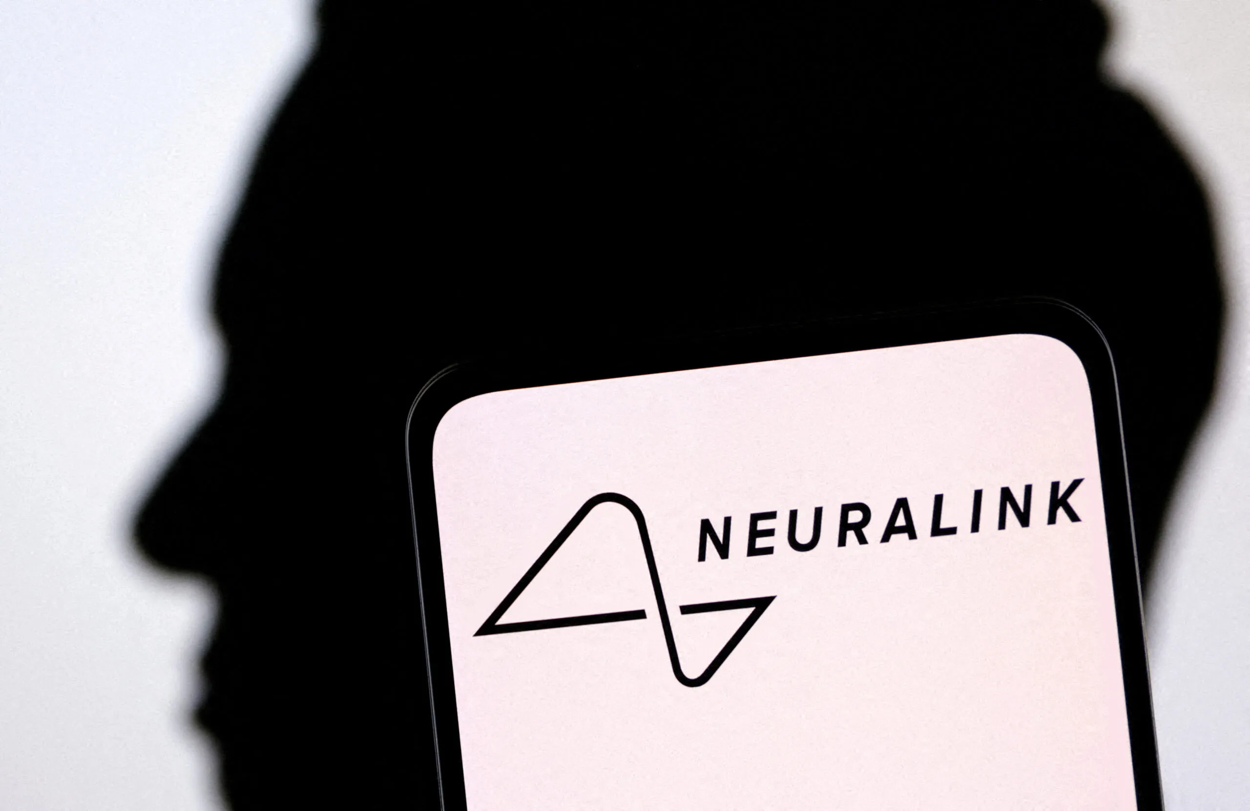 Neuralink’s Wire Troubles Known Before Human Trials Began
