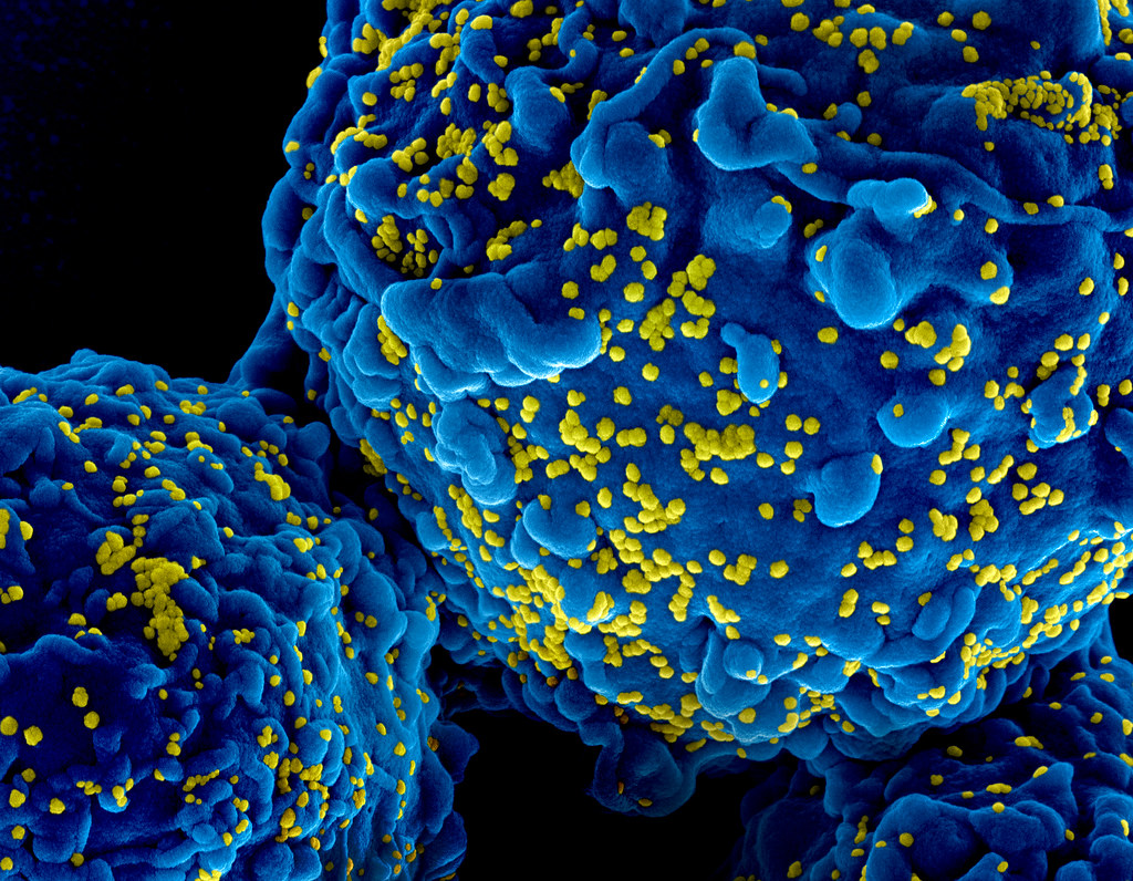 EU Regulator Approves Injectable HIV Drug That Could Prevent Transmission